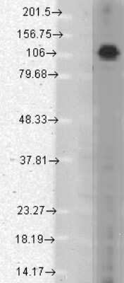 Western Blot: PSD93 Antibody (S18-30) [NBP2-12912]