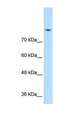 Western Blot: PSD93 Antibody [NBP1-59715]