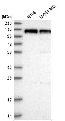 Western Blot: PSD93 Antibody [NBP2-58558]