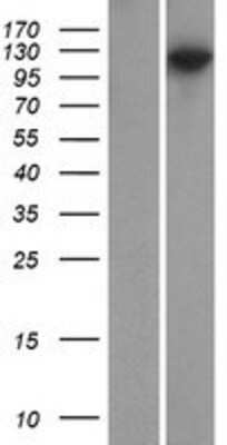 Western Blot: PSD93 Overexpression Lysate [NBP2-11069]