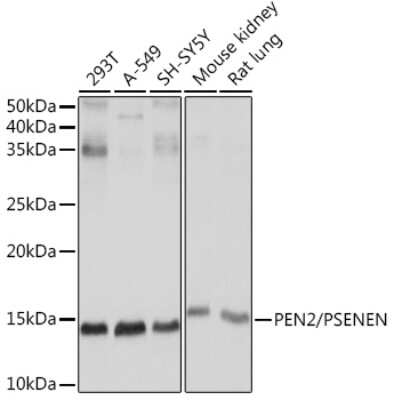 Western Blot: PSENEN/PEN2 Antibody (6J5O4) [NBP3-16676]