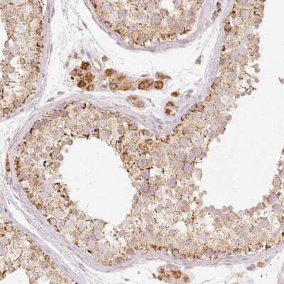 Immunohistochemistry-Paraffin: PSENEN/PEN2 Antibody [NBP2-47319]