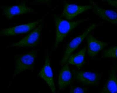 Immunocytochemistry/ Immunofluorescence: PSENEN/PEN2 Antibody (JE41-28) [NBP2-75632]