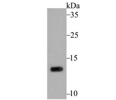 Western Blot: PSENEN/PEN2 Antibody (JE41-28) [NBP2-75632]