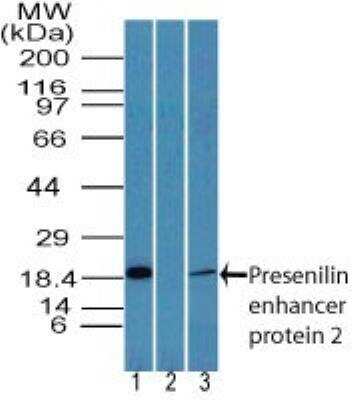 Western Blot: PSENEN/PEN2 Antibody [NBP2-24611]