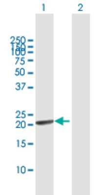 Western Blot: PSF1 Antibody [H00009837-B01P]