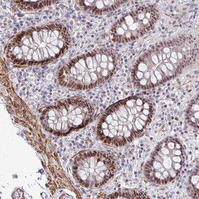 Immunohistochemistry-Paraffin: PSF2 Antibody [NBP2-33825]