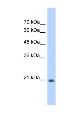 Western Blot: PSF2 Antibody [NBP1-58208]