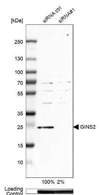 Western Blot: PSF2 Antibody [NBP2-33825]