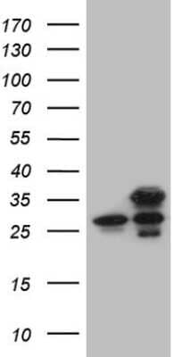 Western Blot: PSF3 Antibody (OTI3A12) [NBP2-45870]