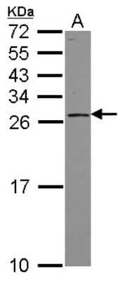 Western Blot: PSF3 Antibody [NBP2-19977]