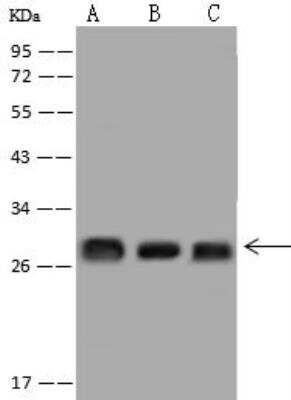 Western Blot: PSF3 Antibody [NBP3-12589]