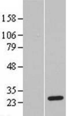 Western Blot: PSF3 Overexpression Lysate [NBL1-11078]