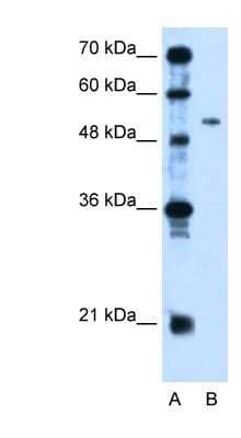 Western Blot: PSG1 Antibody [NBP1-58001]