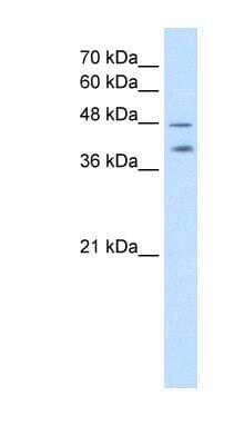 Western Blot: PSG1 Antibody [NBP1-58028]