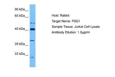 Western Blot: PSG1 Antibody [NBP2-82316]