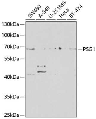 Western Blot: PSG1 AntibodyBSA Free [NBP2-95140]