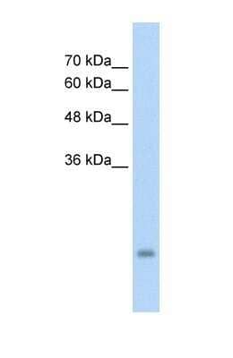 Western Blot: PSG3 Antibody [NBP1-55491]