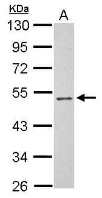 Western Blot: PSG3 Antibody [NBP2-19978]