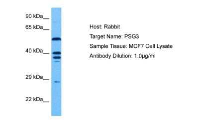 Western Blot: PSG3 Antibody [NBP2-82317]