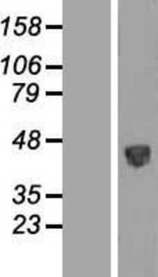 Western Blot: PSG5 Overexpression Lysate [NBL1-14867]