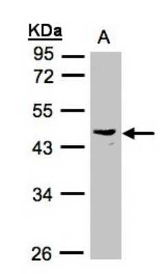 Western Blot: PSG6 Antibody [NBP1-32800]