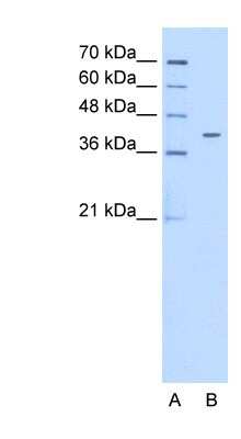 Western Blot: PSG6 Antibody [NBP1-56485]