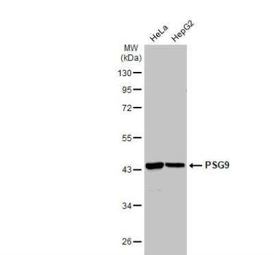 PSG9 Antibody (NBP2-19979) | Bio-Techne