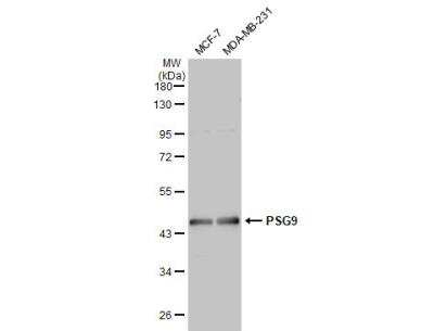 Western Blot: PSG9 Antibody [NBP2-19979]