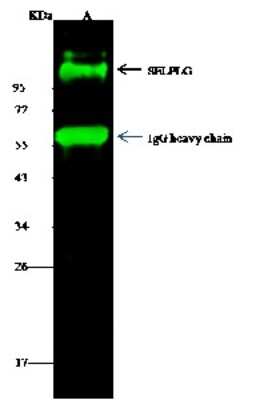 Immunoprecipitation: PSGL-1/CD162 Antibody (108) [NBP2-90249]