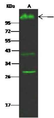 Western Blot: PSGL-1/CD162 Antibody (108) [NBP2-90249]