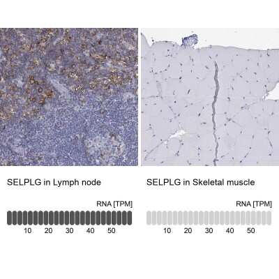 Immunohistochemistry-Paraffin: PSGL-1/CD162 Antibody [NBP3-16974]