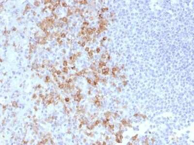 Immunohistochemistry-Paraffin: PSGL-1/CD162 Antibody (PSGL1/1601) - Azide and BSA Free [NBP2-54380]