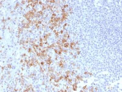 Immunohistochemistry-Paraffin: PSGL-1/CD162 Antibody (PSGL1/1601) [NBP2-53344]