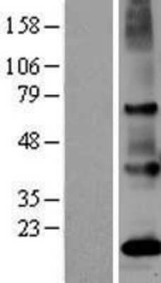 Western Blot: PSGR Overexpression Lysate [NBL1-13961]