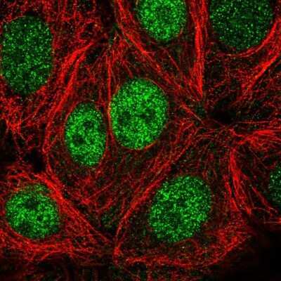 Immunocytochemistry/ Immunofluorescence: PSKH1 Antibody [NBP2-49105]