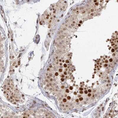 Immunohistochemistry-Paraffin: PSKH1 Antibody [NBP2-49105]