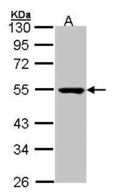 Western Blot: PSKH1 Antibody [NBP1-32668]