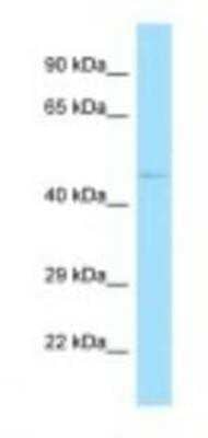 Western Blot: PSKH1 Antibody [NBP1-98573]