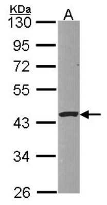 Western Blot: PSKH1 Antibody [NBP2-19981]