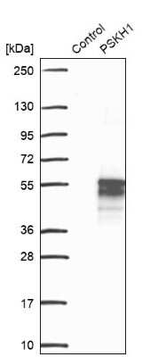 Western Blot: PSKH1 Antibody [NBP2-49105]