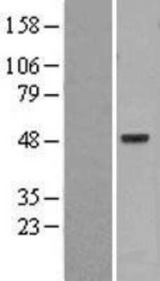 Western Blot: PSKH1 Overexpression Lysate [NBL1-14870]