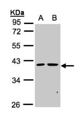 Western Blot: PSKH2 Antibody [NBP1-31467]