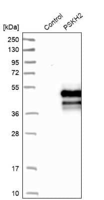 Western Blot: PSKH2 Antibody [NBP1-86459]