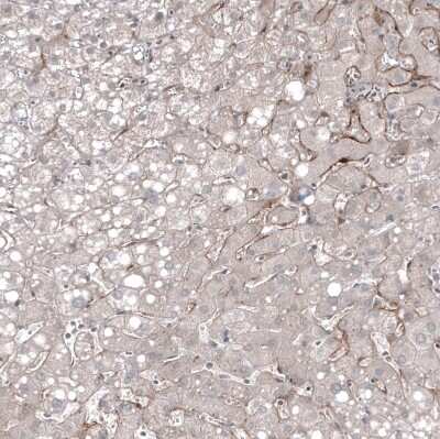Immunohistochemistry-Paraffin: PSMA/FOLH1/NAALADase I Antibody (CL9089) [NBP2-88924]