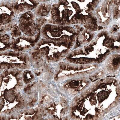 Immunohistochemistry-Paraffin: PSMA/FOLH1/NAALADase I Antibody (CL9089) [NBP2-88924]