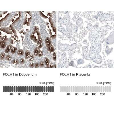 Immunohistochemistry-Paraffin: PSMA/FOLH1/NAALADase I Antibody (CL9091) [NBP2-88925]