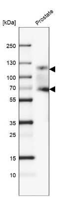 Western Blot: PSMA/FOLH1/NAALADase I Antibody (CL9091) [NBP2-88925]