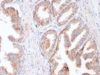 Immunohistochemistry-Paraffin: PSMA/FOLH1/NAALADase I Antibody (FOLH1/3149R) - Azide and BSA Free [NBP3-08463]