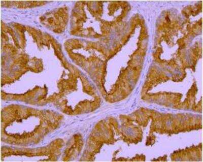 Immunohistochemistry-Paraffin: PSMA/FOLH1/NAALADase I Antibody (GCP-04) - BSA Free [NBP1-45057]